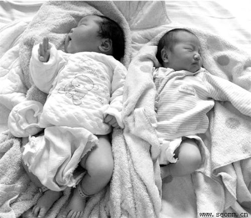 �����Ż�